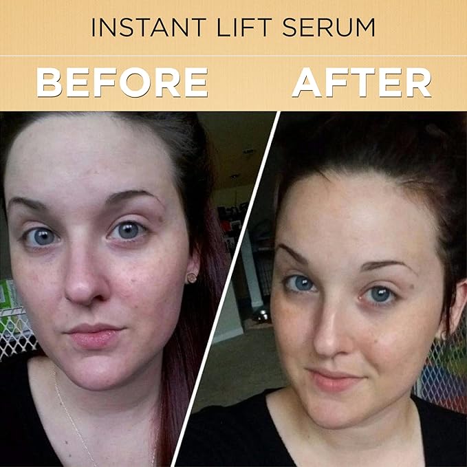 Boto-Derm Rx Instant Lift Serum With Anti Aging FormulaVitamin C Helps to Reduce WrinklesKeeps Skin Hydrated and Nourished Helpful for Normal to Dry Skin Types (20ML)