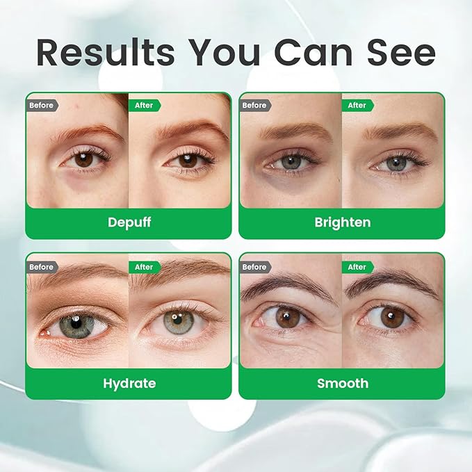 BAOVERI 5% Caffeine Eye Serum. Caffeine Eye Cream with 360° Massage Ball Reduce Wrinkles and Fine Lines, Bags under eyes