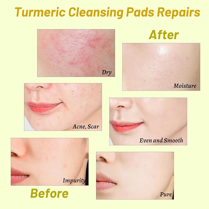 120 pads turmeric cleansing pads
