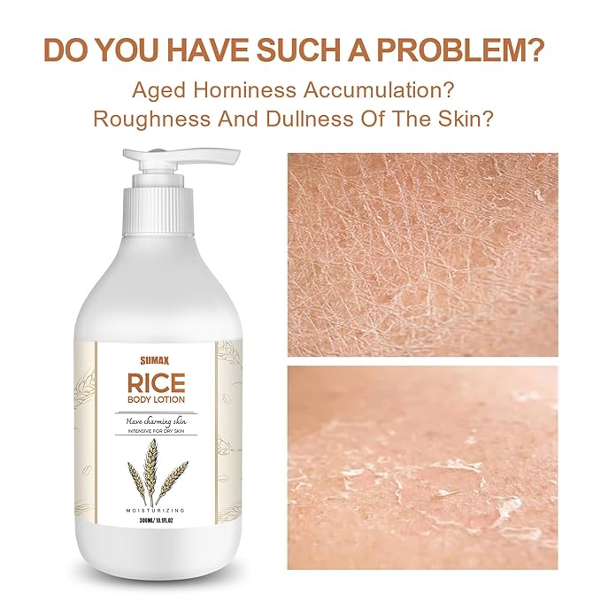 Rice Moisturizing Skin Lotion 10.1oz- Rice Extract - Body Lotion, Hand and Body Moisturizer, Hydrates Dry Skin Instantly, Hydrating Targets Dryness - Face Lotion