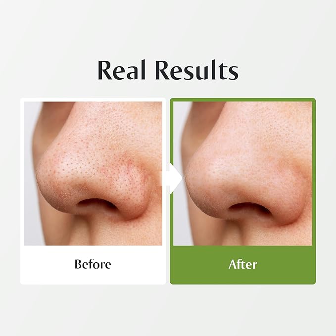 [Redence] Green Grape 3-in-1 Gelato Pore Mask Cleanser, Pore Exfoliating Scrub Mud Mask, No Tightness, Korean Skin Care, 100ml / 3.38 fl oz