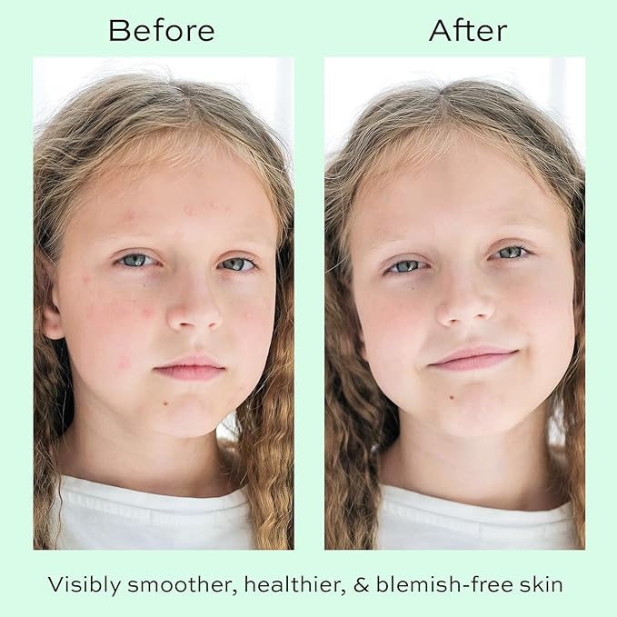 Face Moisturizer with Hyaluronic Acid Face Cream for Kids - Facial Cream & Gentle Moisturizer with Strawberry Extract & Vitamin E - Daily Facial Cream Moisturizer for Dry & Sensitive Skin 50ml