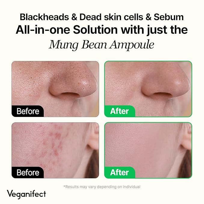 Mung Bean Serum, Enhancing Moisture Barrier, Gentle Exfoliation, For Glow Skin, Korean Skin Care, Vegan, 1.69 Fl Oz