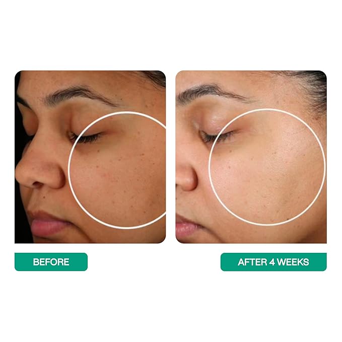 BeautyStat Probiotic 24HR Moisture Boost Cream - Made in the USA - Daily Moisturizer Face Cream with Probiotics, Ceramides, Hyaluronic Acid for Natural Anti Aging, Fine Lines, Wrinkles (1.7oz / 50ml)