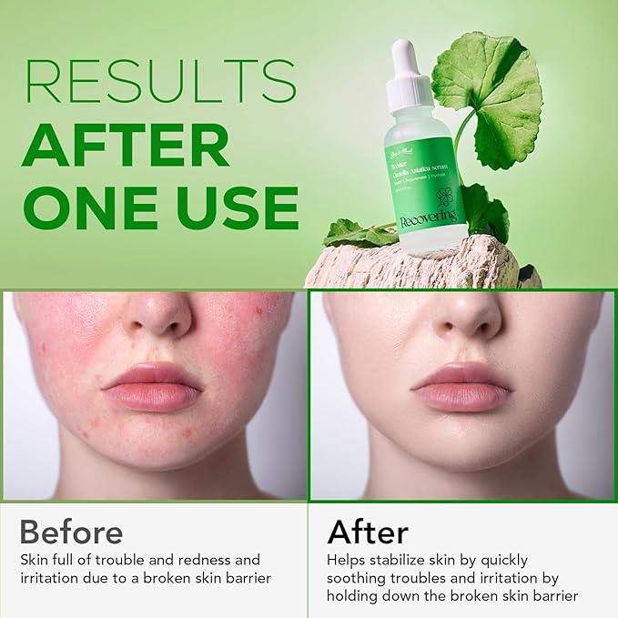 Olivia & Allison Centella Asiatica (CICA) Serum 1.0 fl oz - With Triple Hyaluronic Serum for Intense Hydration for Dewy Glow