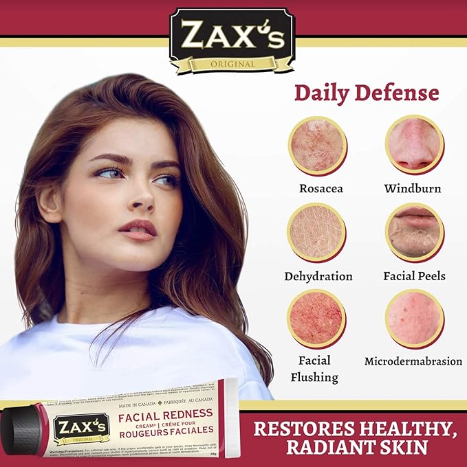 Zax's Facial Redness Diminishing Cream, Rapid Relief for Rosacea, Windburn & Dehydrated Skin, Intensive Moisturizing with Organic Natural Ingredients, Pharmacist Developed, 28g
