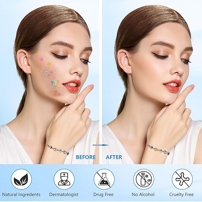 Pimple stars Patches for Face, 4 Size 320 Counts Acne Patches, Hydrocolloid Patches for Covering Zits and Blemishes, Spot Stickers with Salicylic Acid, Tea Tree Oil