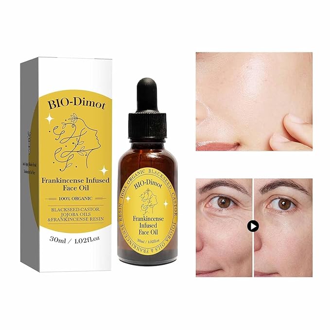 Frankincense Resin Oil For Face，Frankincense Resin Infused Organic Black Seed & Jojoba Oils,Natural skin Care moisturizing, Facial Anti-Aging Moisturizing skin Serum (1)