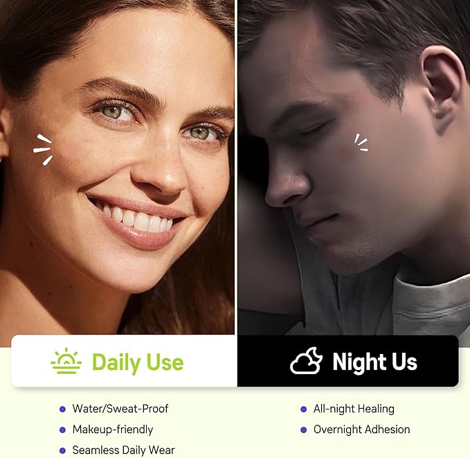 Pimple Patches for Face, Invisible Hydrocolloid Acne Patches Acne Treatment,Covering Zits & Blemishes in Skin and Face, Zit Patches with Salicylic Acid, FSA HSA Store Eligible Items 120 Count