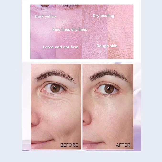 luxury face serum for women - anti aging hydrating essence with hyaluronic acid, moisturizing facial care to improve dryness, fine lines (3.38oz Essential Water+3.53oz Essential Lotion)