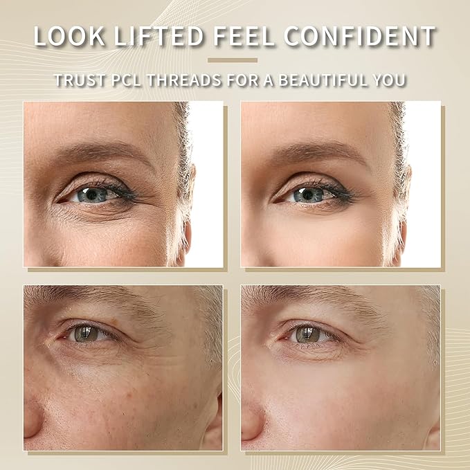 elves PCL Threads for Face Lift Mono Threads 27G60mm Pcl Smooth Threads Sharp Tip PCL Threads Mono 20Pcs Long-Lasting Skin Tightening Smoothing of Wrinkles