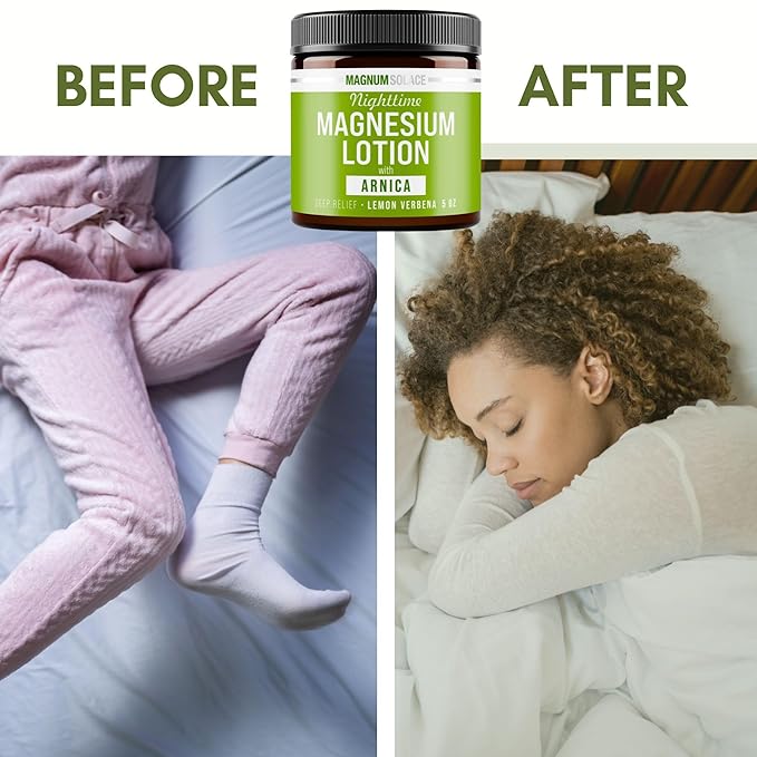 Nighttime Magnesium Lotion with Arnica – Soothing Relief & Relaxation, Highly Concentrated Magnesium for Muscles & Joints – Apply to Legs or Feet Before Bed – Skin-Friendly