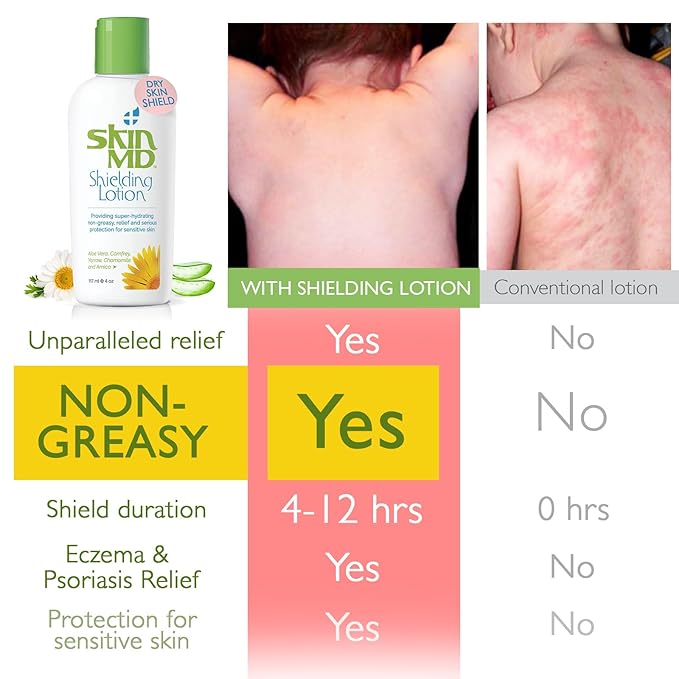 Skin MD Shielding Lotion 4oz. - hydrating, non-greasy, relief & serious protection for sensitive skin