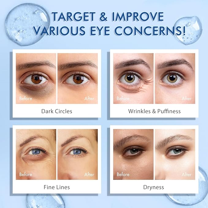 5% Caffeine Eye Serum, Under Eye Roller Cream for Dark Circles, Puffiness, Bags Under Eyes - 360° Massage Ball Cream for Wrinkles, Christmas Gifts for Women (0.5 fl. oz.)