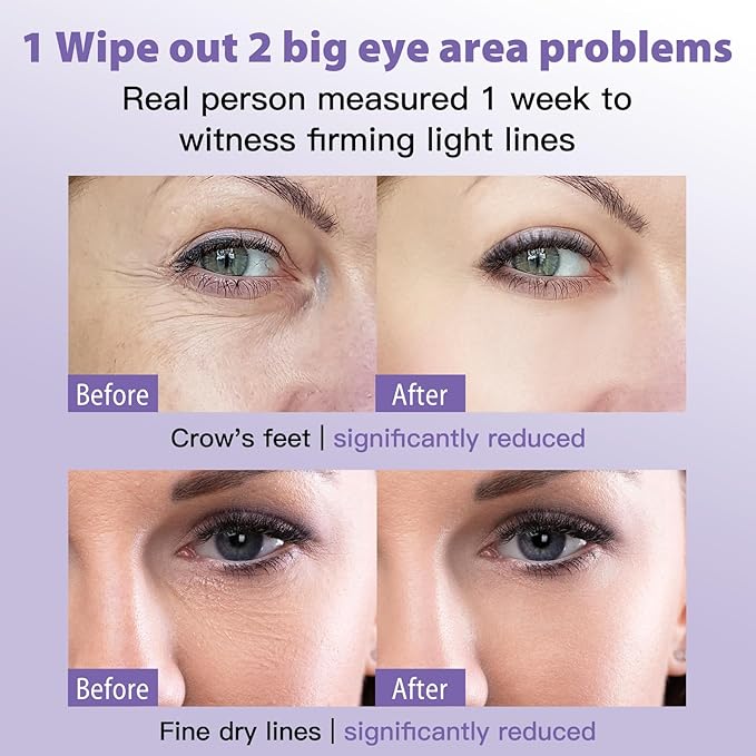 Eye Face Serum, Firming Anti-Wrinkle Serum, Reduces Eye Bags, Dark Circles, with Vitamin E, Helps Anti-Aging Eye Serum, 0.7 oz