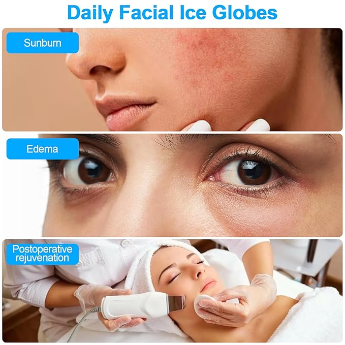 CGBE 360 Rotating Ice Globes for Face, Food-Grade Stainless Steel Facial Globes for Cryo Therapy, Smaller Ice Globes for Facials Reduce Wrinkles & Swelling - White