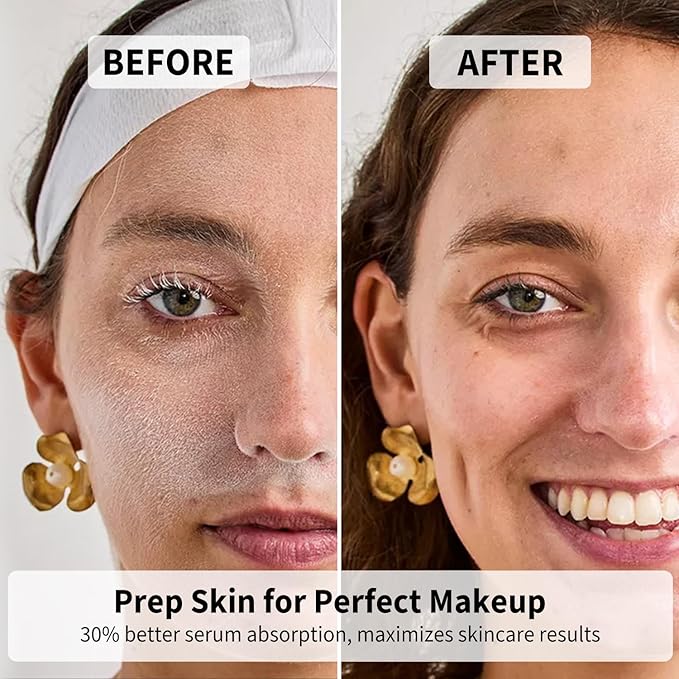 Face Razors for Women, Dermaplane Razor for Women Face, Eyebrow Razor, Facial Razors, Dermaplaning Tool, Gentle Skin Exfoliation Microblades for Sensitive Skin, Peach Fuzz Remover, 10 Count