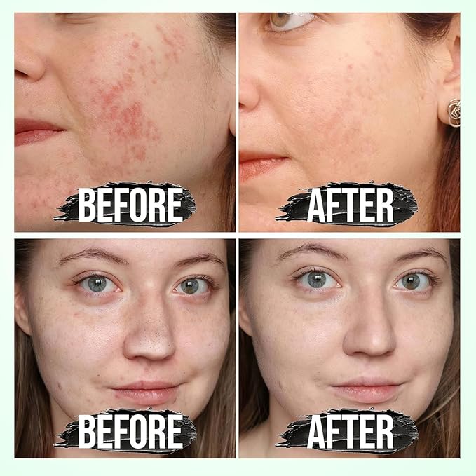 Blackhead Remover Mask - Charcoal Peel Off Nose Blackhead Remover, Pore Remover, Deep Cleansing for Face Nose Blackhead Pores Acne for All Skin Types