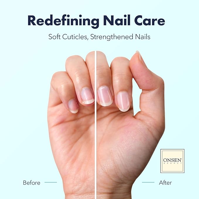 Onsen Secret Nail & Cuticle Repair Oil (2x10ml) - Dry Oil Formula - Japanese Tsubaki, Tea Tree & Jojoba - Strengthens Nails, Repairs Cuticles, Hydrates Skin & Hair - Natural & Vegan