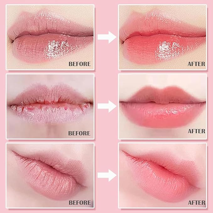 6 PCS Bee Lip Balm Honey Pot,Honey & Strawberry & Watermelon & Apple Lime & Cherry & Mint Lip Mask Overnight Hydrating Prevention Dry and Cracked Lip Scrubs Exfoliator Lip Care, Reduces Lip Lines