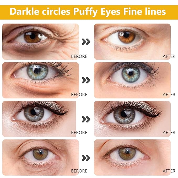 Permotary 15 Pairs Collagen Eye Mask and 15 Pcs Mositurizing Lip Mask, Under Eye Patches and Lip Pads, Crystal Patches Set for Wrinkles, Moisturizing, Reducing Fine Lines & Dark Circles