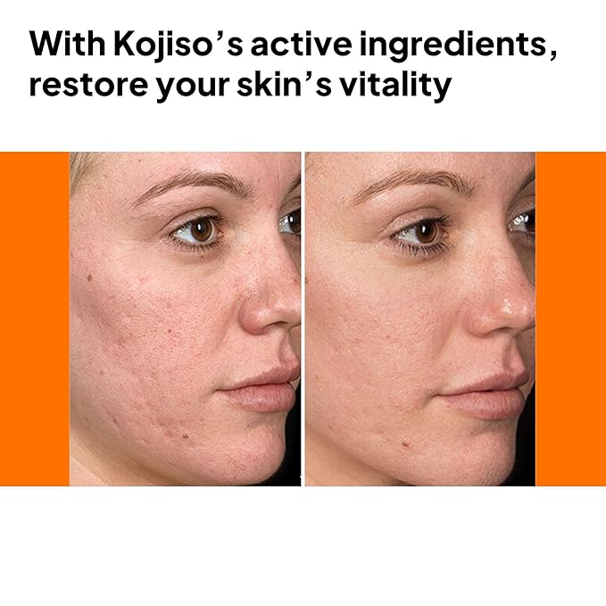 pH Lab Kojiso Skin Serum, Even Skin Tone (Pack of 1)