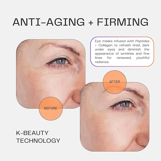 Collagen Under Eye Mask Patches (Anti-Aging + Firming 20 Pairs) with Niacinamide + Peptides - Anti-Aging, Fine Lines, Wrinkles, Dark Circles, Puffy Eyes, Under Eye Bags - Mother's Day Gifts