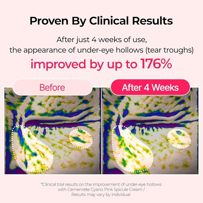 Cemenrete Cyano Pink Spicule Cream with Calcium, Vitamin B12 for under eyes skin, Dark Circles, Fine Lines, Puffiness&Eye Bags Cream, 1.69 fl. oz.