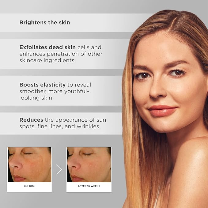 Glytone Night Renewal Cream with 5.5 Free Acid Value Glycolic Acid & Retinaldehyde, Improves Skin Elasticity, Reduce Appearance of Fine Lines & Wrinkles, 1.7 oz.