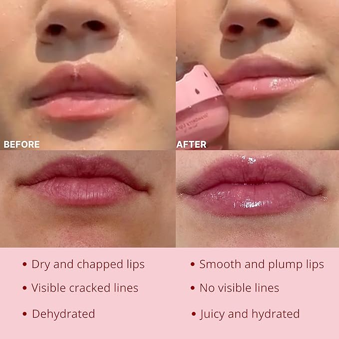 Original My Bee Balm Lip Balm - Strawberry Hydrating Balm Honey Pot for Dry, Chapped & Cracked Lips with Propolis, Honey & Vitamin E - Soften, Smooth & Reduce Lip Lines
