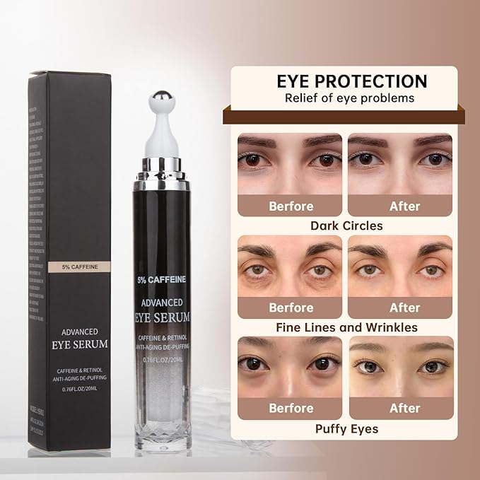 Caffeine Eye Cream for Puffiness & Dark Circles, Under Eye Cream for Puffy Eyes, Eye Bags & Wrinkles, 2 PCS Anti Aging Eye Serum with Under Eye Roller, Reduces Fine Lines & Moisturize Skin.