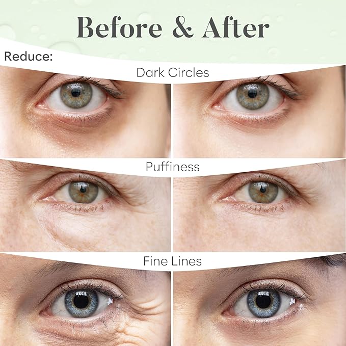 Green Tea Under Eye Patches (30 Pairs) Under Eye Patches for Dark Circles, Under Eye Patches for Puffy Eyes and Dark Circles, Under Eye Mask, Eye Care, Puffy Eyes Treatment