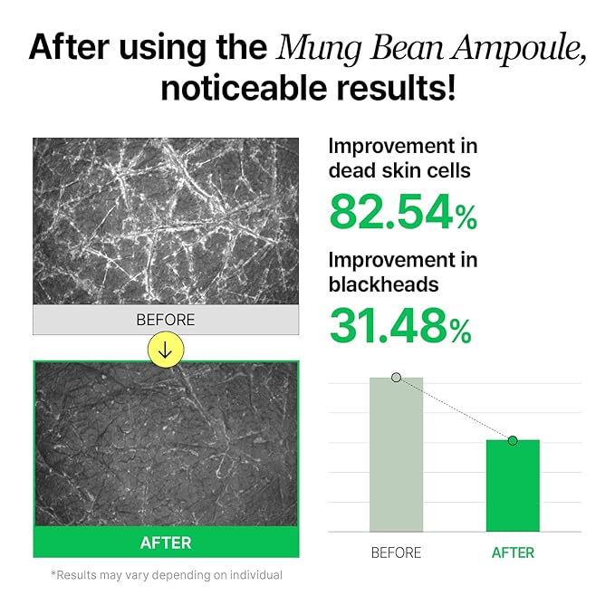 Mung Bean Serum, Enhancing Moisture Barrier, Gentle Exfoliation, For Glow Skin, Korean Skin Care, Vegan, 1.69 Fl Oz