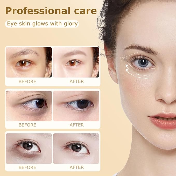 Dinkiss Lutein Eye Essence Oil - Lutein Eye Essence Oil, Lutein Eyes Vc Cream to Improve Eyes Bags Dark Circles (2pcs, 8ml/pcs)
