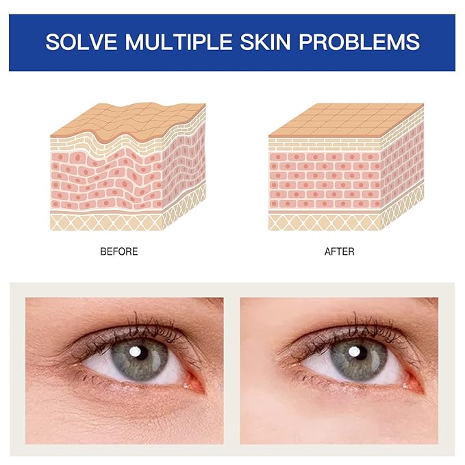 Eye Cream Reducing Fine Lines and Wrinkles Anti-Aging Eye Cream Repairing Dark Circles and Puffy Eye Cream 0.7 oz (shark)