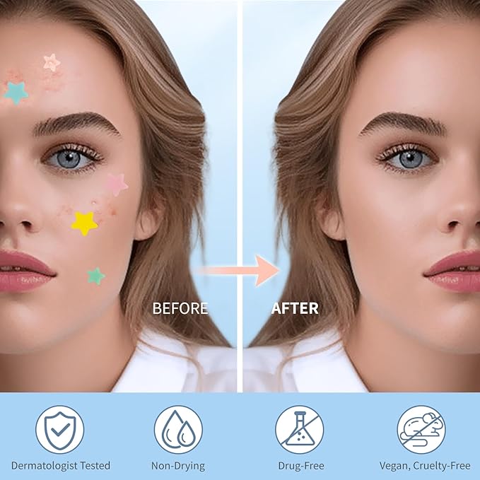 Pimple Patches for Face, Hydrocolloid Acne Patches, Cute Star Zit Covers, Colorful Spot Stickers with Tea Tree, Salicylic Acid & Cica Oil| 3 Sizes (10mm, 12mm & 14mm) |200 Count