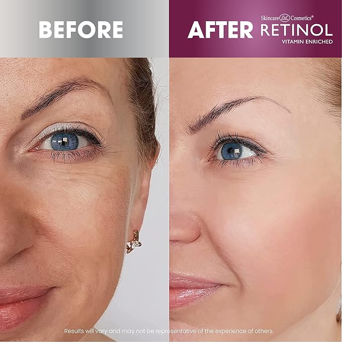 Retinol Anti-Aging Day Cream Broad Spectrum SPF 20 Moisturizes & Reduces Look of Fine Lines Anti-Aging Eye Gel Pads – Soothing Vitamin A Reduces Puffiness & Refreshes the Under Eye Area.