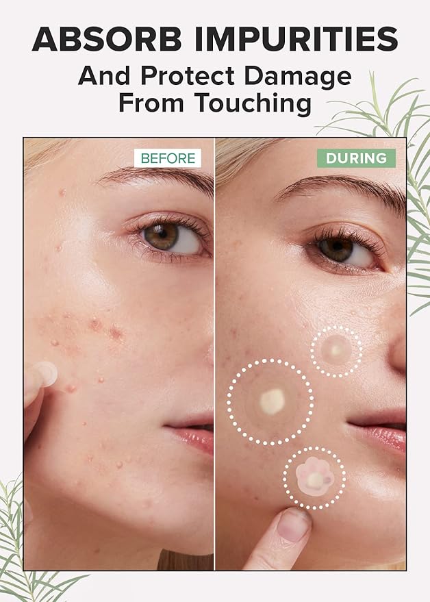 I DEW CARE Skin Care Set - Starlit Kitten & Meet Your Patch & Proper Popper | Eye Patches, Variety Pimple, Glass Skin, Hydrating, Facial Treatment, Blackhead Remover