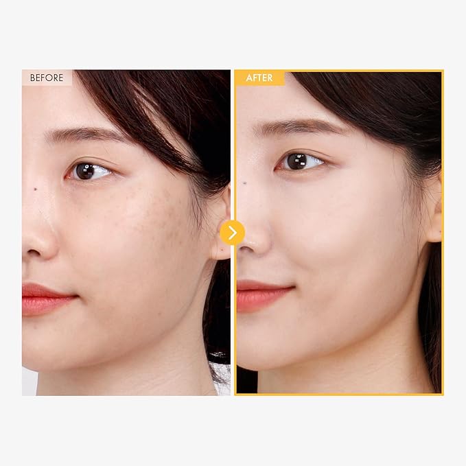 8 Days Spot Cream, Dark Spot Remover for Face, Age Spot, Sun Spot, Freckles, Melasma, Brown Spot Serum, Advanced Formula Corrector Cream with Niacinamide for Women and Men, 50g, 1.76 oz.