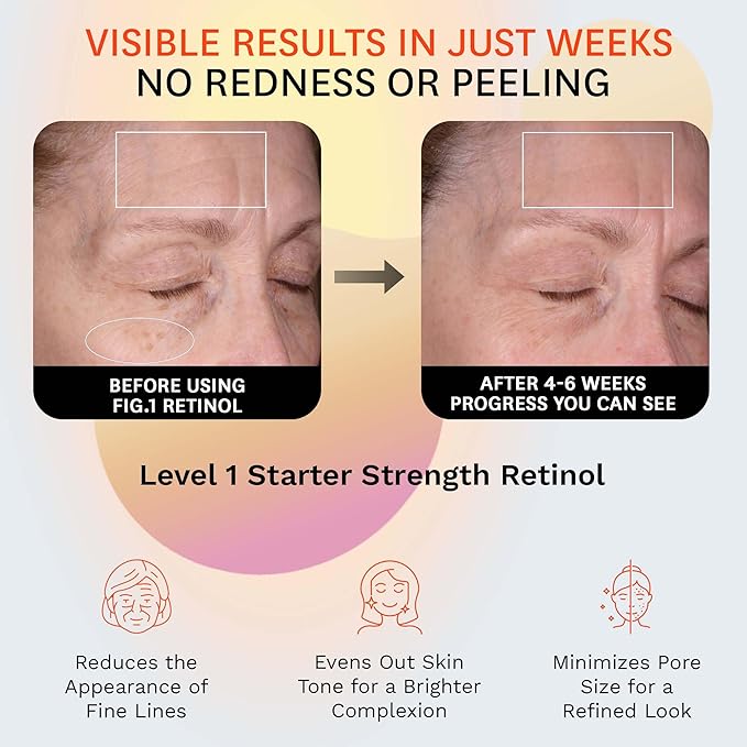 Fig.1 Retinol Night Cream | Face Hydrating Moisturizer With Retinol & Squalane | Night Cream For Women With Sensitive Skin | Dermatologist-Tested Wrinkle Reduction | Level 1 of 3, 50ml / 1.7 fl oz