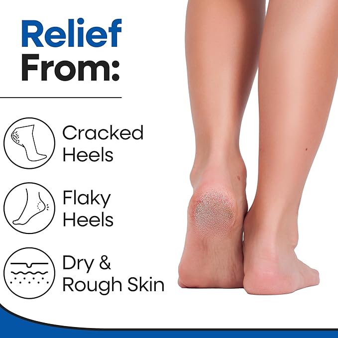 Moisturizing Socks for Women & Men | Aloe Vera Cracked Heel Treatment | Foot Callus Remover | Aloe Socks for Cracked Heels & Dry Cracked Feet | Lotion Infused Gel Heel Socks (Large - 3 Pairs)