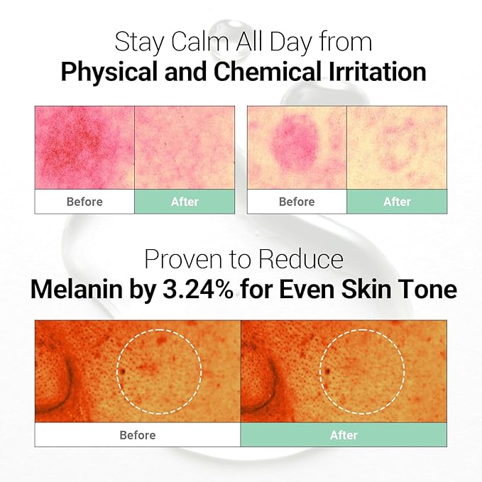 Soothing Calm Ampoule with Niacinamide, Spot Care Hyaluronic Acid, Non-Greasy, CICA Healing and Gentle Formula (30ml /1.01 oz) Radiant Serum, Korean Skincare