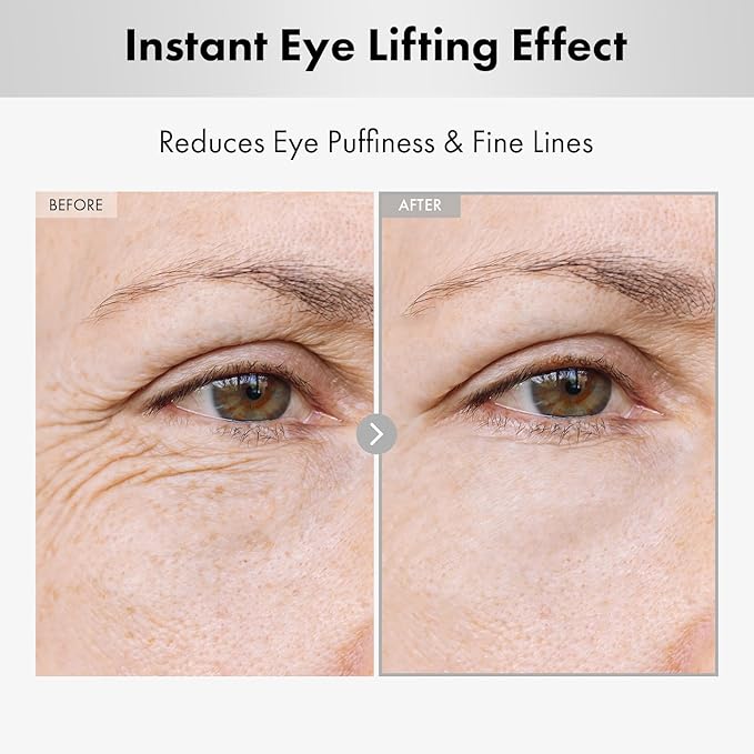 Hyaluron Lifting Eye Cream, Hyaluronic Acid, 5% arbutin, Niacinamide for Puffy Eyes, Dark Spot and Fine Lines, Hydrating Under Eye Bag, Korean Skin Care, 15ml, 0.5 fl. oz.