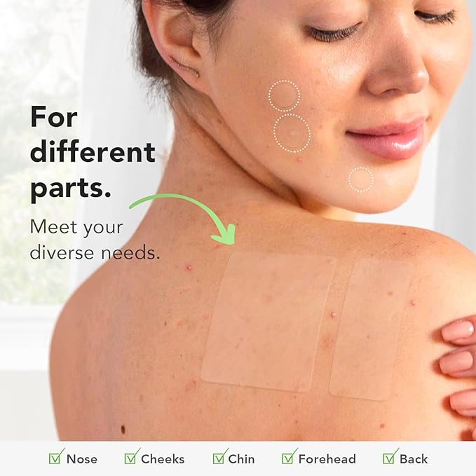 Pimple Patches (6 Sizes 188 Patches), Acne Patches for Large Zit Breakouts, Hydrocolloid Bandages for Face, Chin, Nose, Forehead, Body, Back, Neck & Chest, Round, Rectangle and Square Hydrocolloid