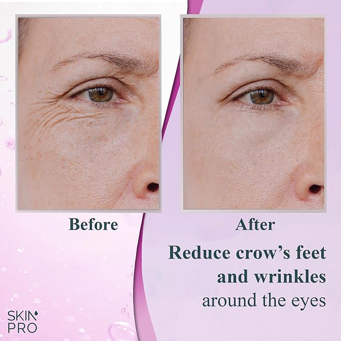 Elite Serum 10 - Natural Anti Aging Eye Serum and Anti Wrinkle Treatment - Eye Bags and Dark Circles Remover with Advanced Formulation of Hyaluronic Acid, Collagen, Argireline and Peptides