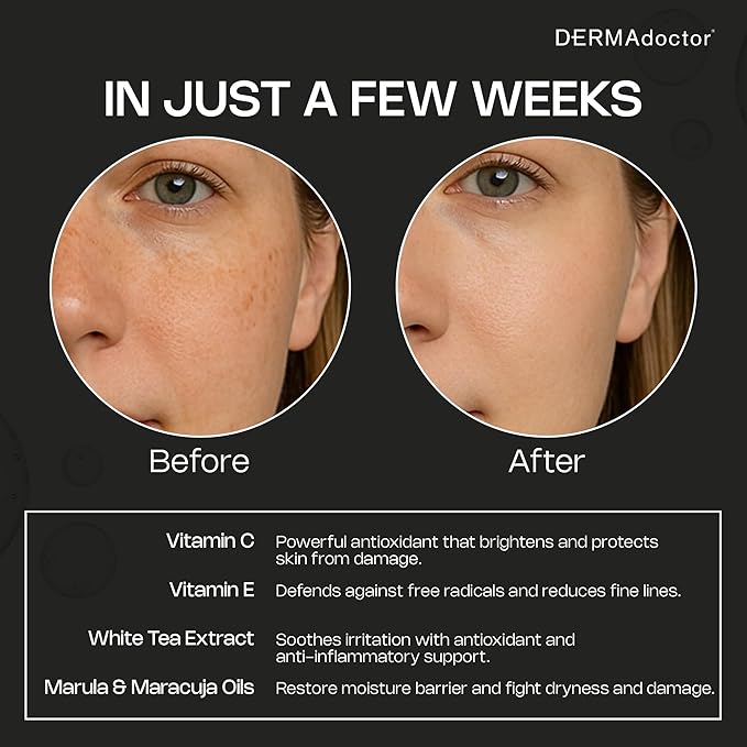 DERMAdoctor 20% Vitamin C Face Oil with Vitamin E & Ferulic Acid | Kakadu C High-Potency Evening Oil, Anti-Aging, Brightening & Hydrating Glow | For All Skin Types – 1.01 fl oz