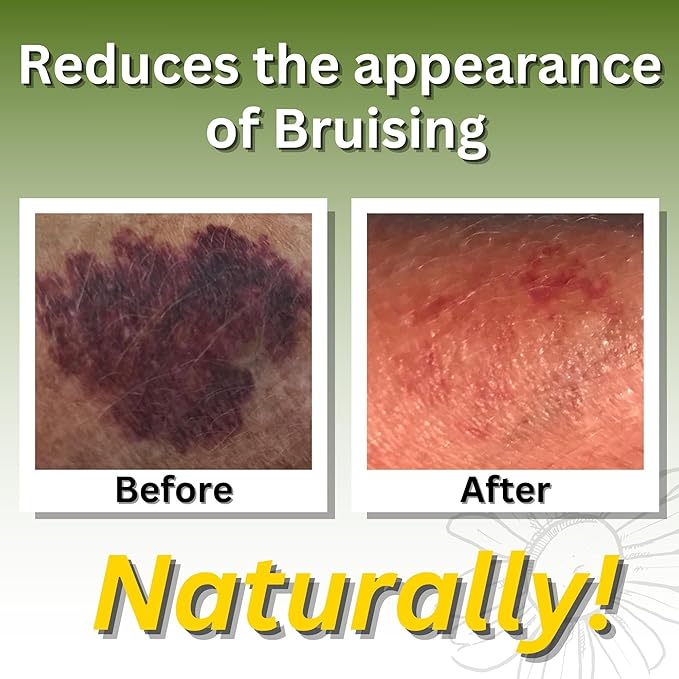 Relief Arnica Massage Oil for Massage Therapy, Home Use & Therapeutic Massaging | Great for Lymphatic Drainage, Sore Muscles & Joints | All Natural with Arnica Montana & Lemongrass Essential Oil