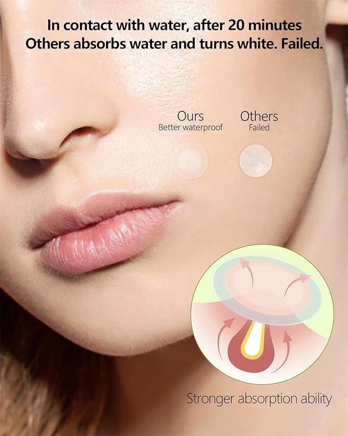 Beviliu Pimple Patches for Face 132 Counts, 2 Sizes Thinner Edge Hydrocolloid Acne Patches, Invisible Zit Patches for Face, Facial Skin Care Products Beauty