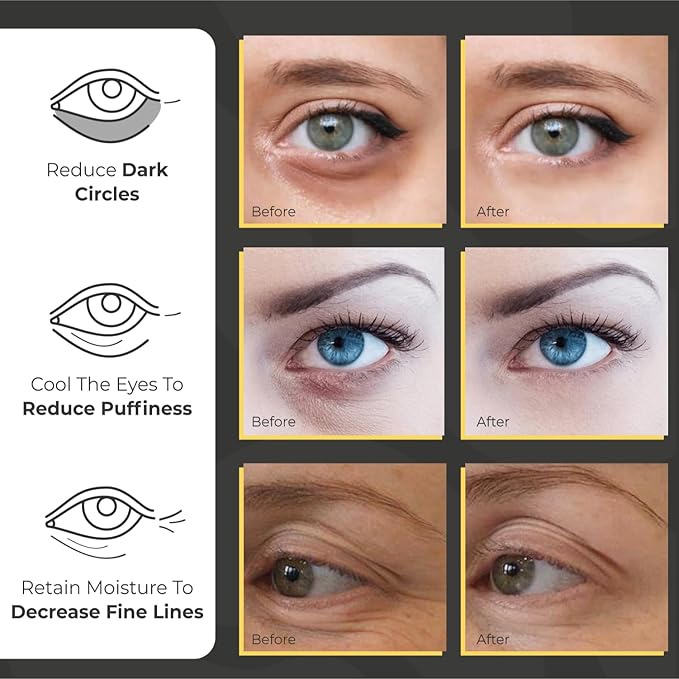 Daytime Under Eye Patches for Puffy Eyes and Dark Circles | Infused Gel Mask Patches for Dark Circle Undereye Support of Bags & Puffiness | Ideal for Bridesmaid Gifts & Bachelorette Party