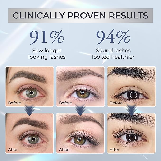 Abera Misan Eyelash Growth Serum (Upgrade Version) - Natural Lash Booster and Lash Enhancer, Regenerating and Nourishing Lashes Longer and Thicker (B. Set of 2)